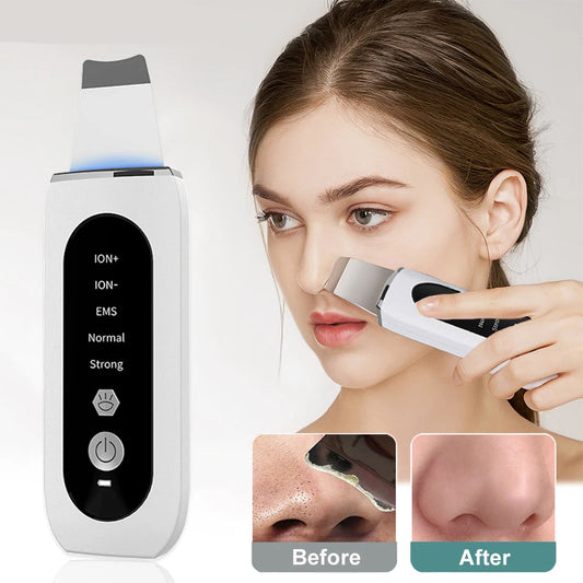 GlowSkin Ultrasonic Cleanser